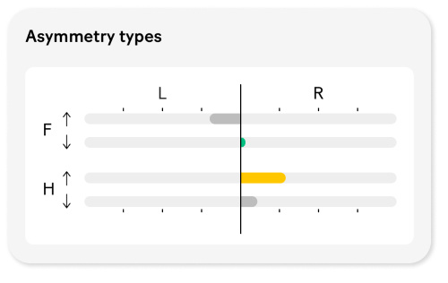 Asymmetry types - Notting Hill