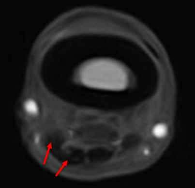 mri-coolman-1