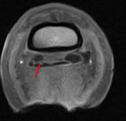 mri-coolman-2