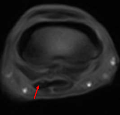mri-coolman-3