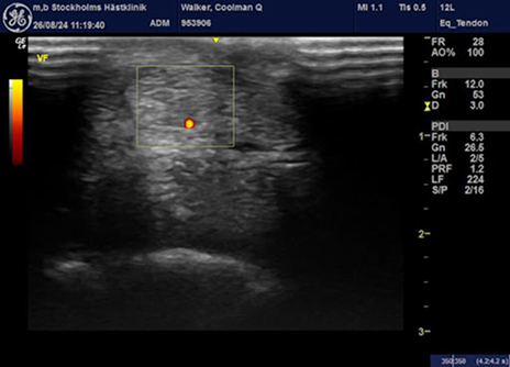 ultrasound-3
