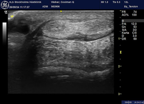 ultrasound2