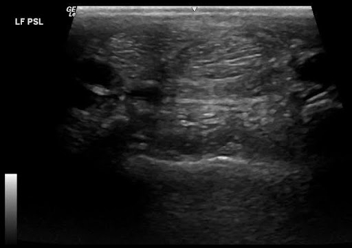 Ultrasound-1-Scarlette