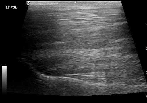 Ultrasound-2-Scarlette