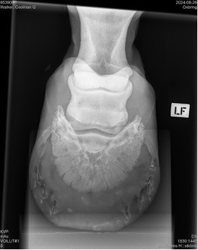 Xray1