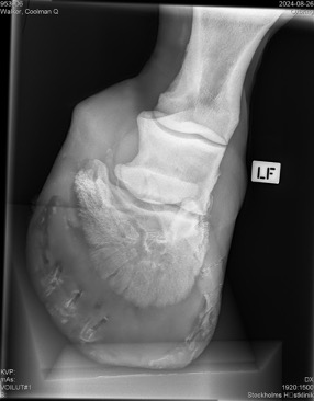 Xray2