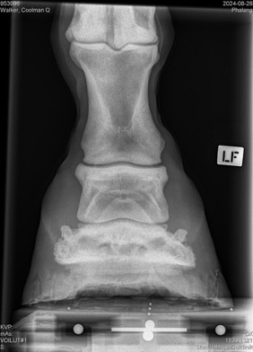 xray4
