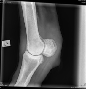 xray6